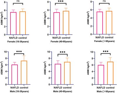 Gender difference in association between low muscle mass and risk of non-alcoholic fatty liver disease among Chinese adults with visceral obesity